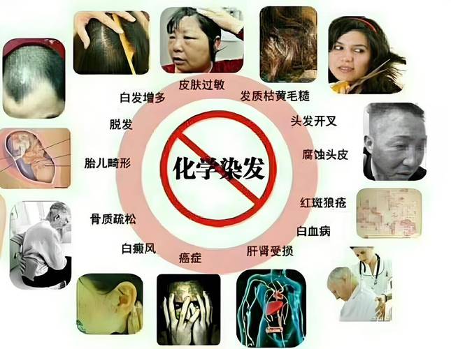 包含女子染发多年选择与白发和解的词条